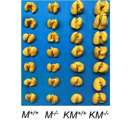 Open access visualization of Photo, Lung Cancer Development, Mice, Wild-type Mtss1, Mtss1 Knockout