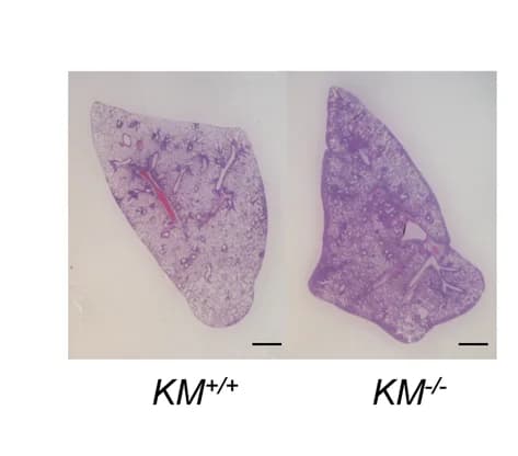 Open access visualization of Microscopy, Lung Cancer Development, Mice, Wild-type Mtss1, Mtss1 Knockout