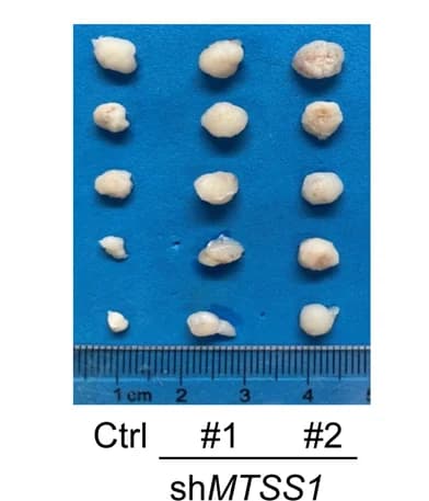 Open access visualization of Photo, Growth Curves, H1975 Tumors, MTSS1 Knockdown, PBMC-Humanized NOG Mice