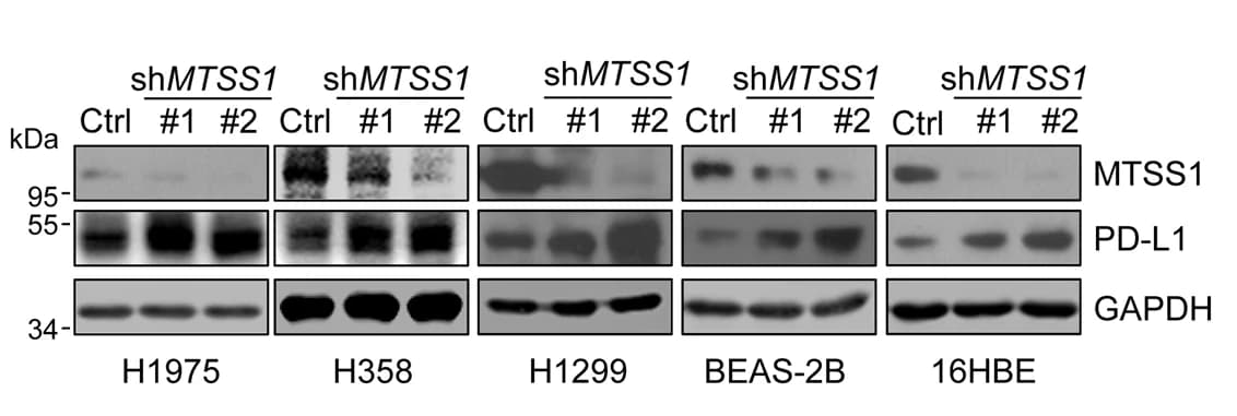 Open access visualization of Gel, MTSS1, PD-L1, Protein Levels, Lung Bronchial Cell Lines