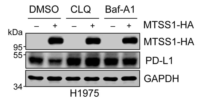 Open access visualization of Gel, PD-L1 Protein Levels, H1975 Cells, MTSS1 Overexpression, Lysosome Inhibitors