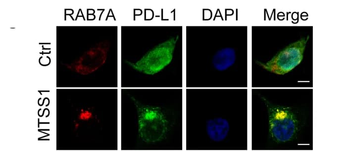 Open access visualization of Microscopy, Immunofluorescence, PD-L1, Endocytic Organelle Marker RAB7A, H1975 Cells