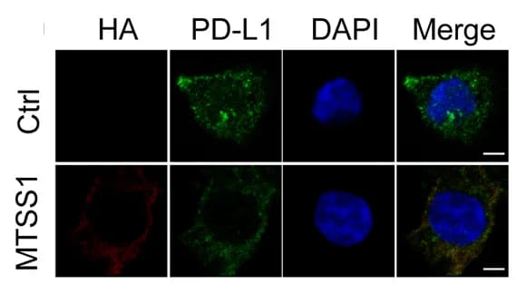 Open access visualization of Microscopy, Immunofluorescence, MTSS1, PD-L1, H1975 Cells