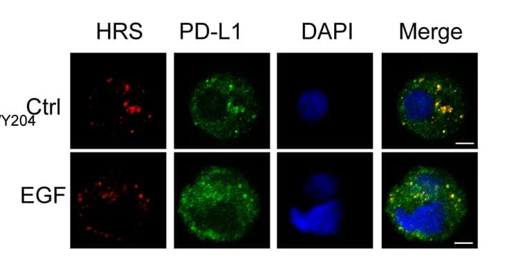 Open access visualization of Microscopy, IF Analyses, PD-L1, HRS, 16HBE Cells