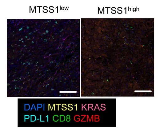 Open access visualization of Microscopy, mIHC Staining, LUAD Samples