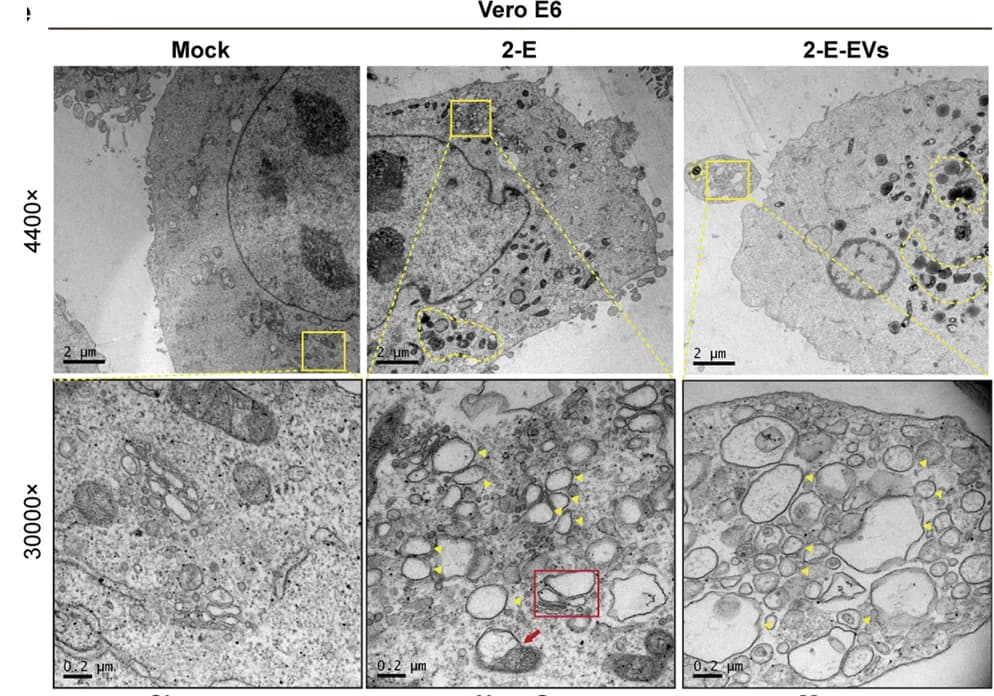 Open access visualization of Microscopy, TEM images, Vero E6 Cells, Extracellular Vesicles, SMVs