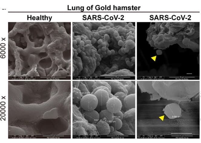 Open access visualization of Microscopy, SEM Images, Golden Hamster, Lung Tissues, SARS-CoV-2