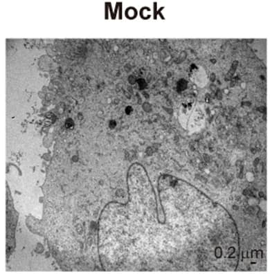 Open access visualization of Microscopy, TEM, Vero E6 Cells, SARS-CoV-2, Double-Membrane Vesicles
