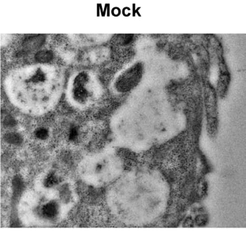 Open access visualization of Microscopy, Photo, Immunoelectron Microscopy, Vero E6 Cells, SARS-CoV-2