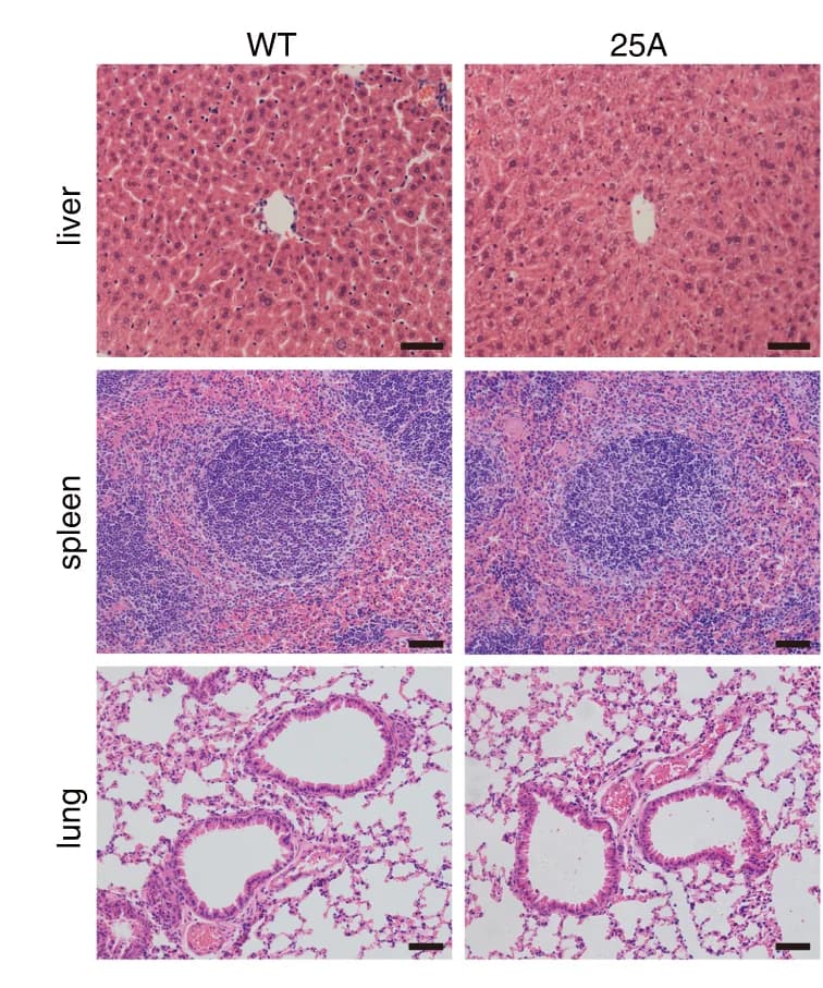 Open access visualization of Microscopy, HE Staining, Liver, Spleen, Lung