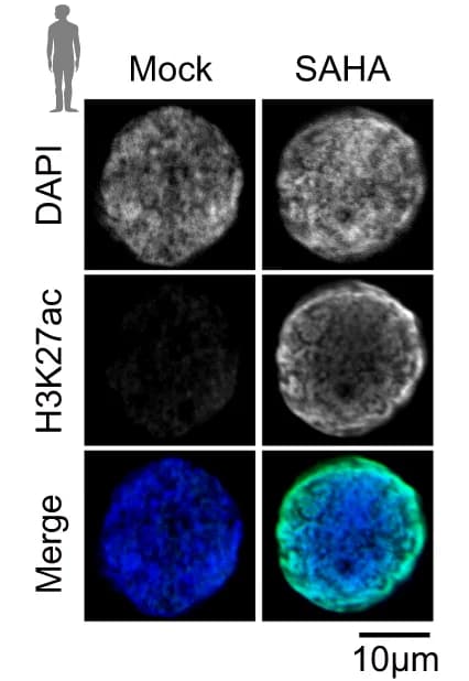 Open access visualization of Microscopy, Immunostaining, H3K27ac, Human 8-cell embryos, SAHA treatment