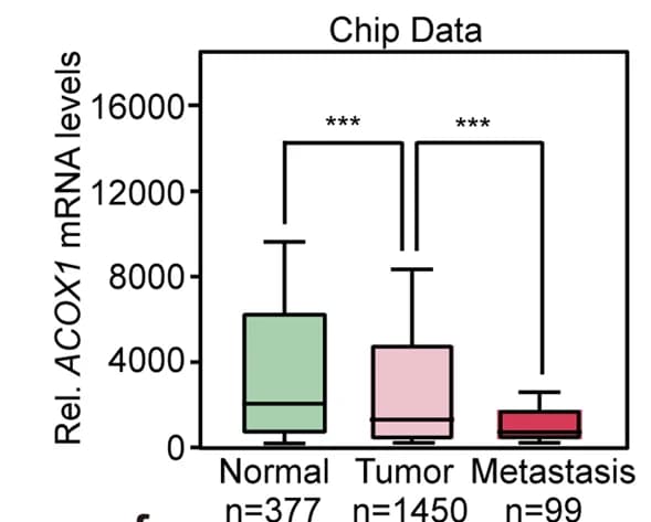 Open access visualization of Box Plot, ACOX1 expression, Normal Tissues, Primary Tumor Tissues, Metastatic Tumors