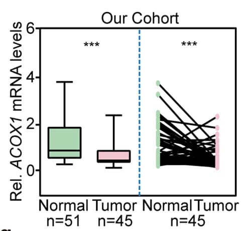 Open access visualization of Box Plot, Line Plot, ACOX1 expression, Normal Tissues, Primary Tumor Samples