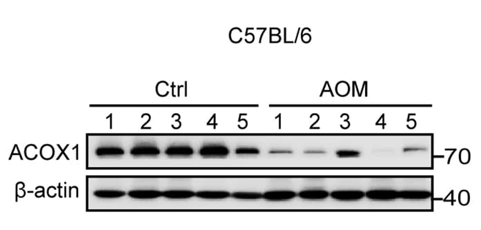 Open access visualization of Gel, ACOX1 Protein Expression, Tumor Samples, CRC mice, Immunoblotting