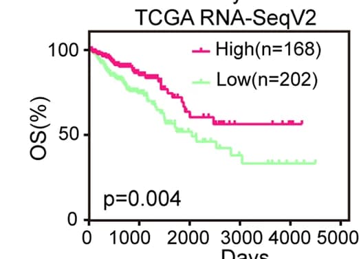 Open access visualization of Survival Curve, Line Step, Kaplan-Meier Survival Curves, CRC Patients, ACOX1 Protein expression
