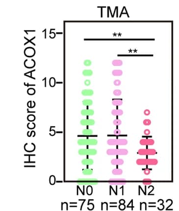 Open access visualization of Scatter Plot, ACOX1 Protein, Lymph Node Metastases, CRC TMA, Patients