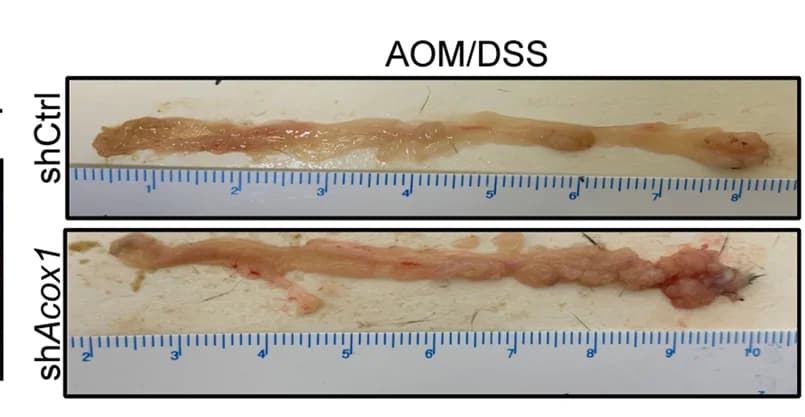 Open access visualization of Photo, Macroscopic Morphology, C57BL/6 Mice, Control Group, ACOX1 Depletion