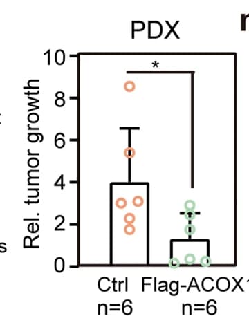 Open access visualization of Box Plot, Scatter Plot, PDX Growth, ACOX1 Overexpression, BALB/c Nude Mice