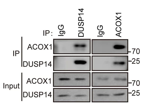 Open access visualization of Gel, Endogenous Interaction, ACOX1, DUSP14, HCT15 Cells