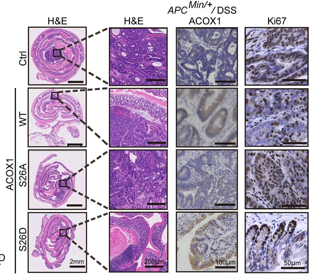 Open access visualization of Microscopy, H&E Staining, Ki67 Staining, Mice, Control Group