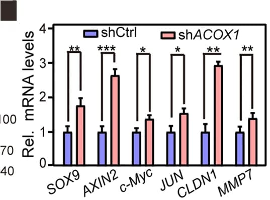 Open access visualization of Bar Plot, Error Bars, Beta-catenin, ACOX1, RT-qPCR