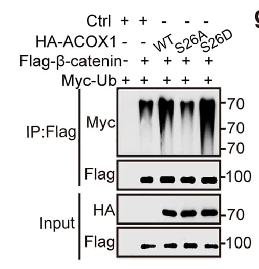 Open access visualization of Gel, Beta-catenin, ACOX1, Polyubiquitination, HEK293T Cells