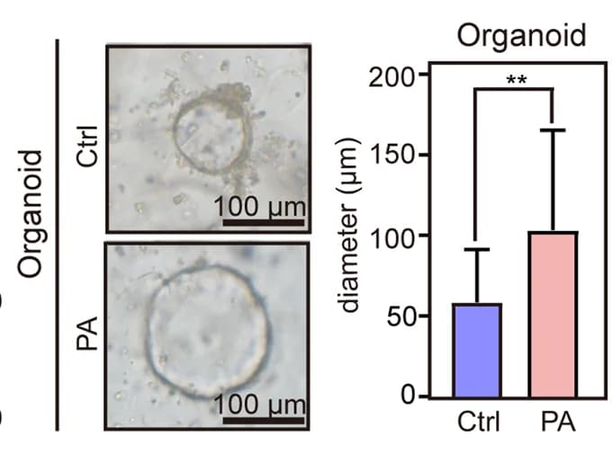 Open access visualization of Bar Plot, Error Bars, Microscopy, Colonic Organoids, PA Treatment