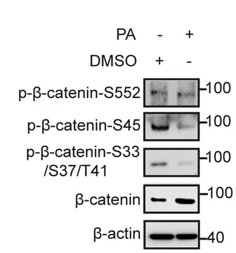 Open access visualization of Gel, Beta-catenin, Phosphorylation, PA Treatment, HEK293T Cells