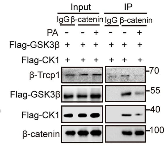 Open access visualization of Gel, Beta-catenin, CK1, GSK3beta, beta-Trcp