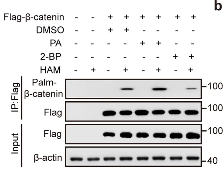 Open access visualization of Gel, Beta-catenin, Palmitoylation, HEK293T Cells, 2-BP