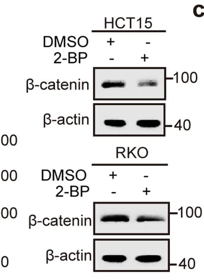 Open access visualization of Gel, Beta-catenin, Abundance, 2-BP, HCT15 Cells