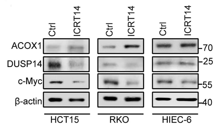 Open access visualization of Gel, ACOX1 Expression, DUSP14 Expression, c-Myc Expression, beta-catenin Inhibition