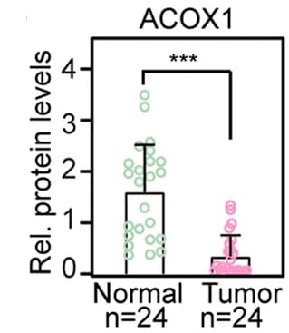 Open access visualization of Box Plot, Raincloud Plot, Protein Levels, ACOX1, Densitometry