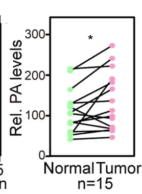 Open access visualization of Scatter Plot, PA Levels, Normal Tissues, Tumor Tissues