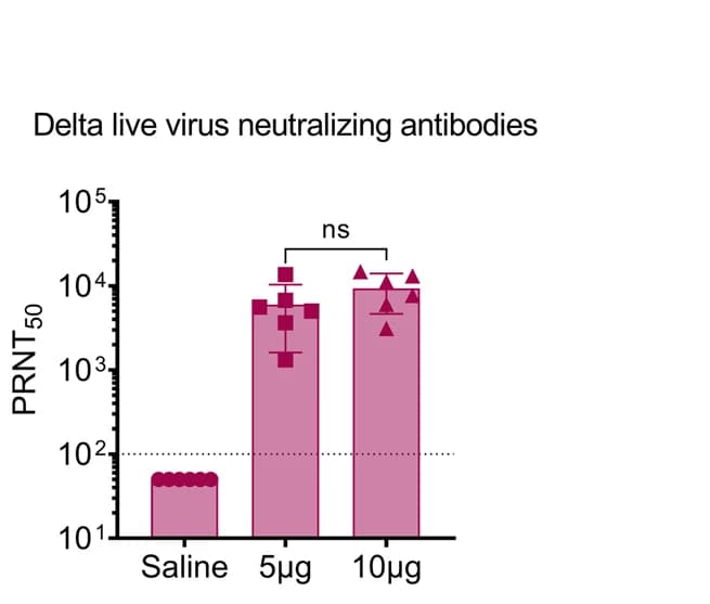 Open access visualization of Bar Plot, Error Bars, Virus load, Brain, Statistical Analysis
