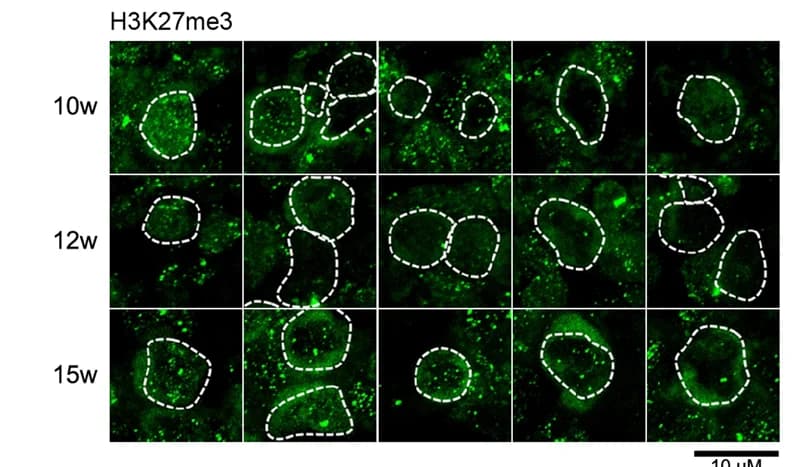 Open access visualization of Microscopy, Immunofluorescence, Female hPGCs, H3K27me3, c-KIT positive hPGCs
