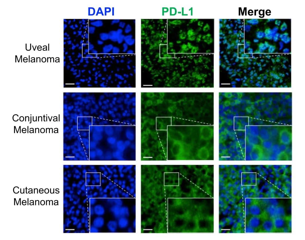 Open access visualization of Microscopy, IF Staining, PD-L1, UM, CoM