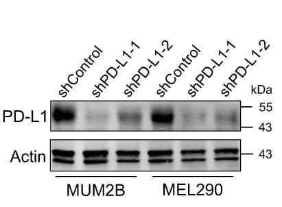 Open access visualization of Gel, Western Blot, UM Cell Lines, MUM2B, MEL290