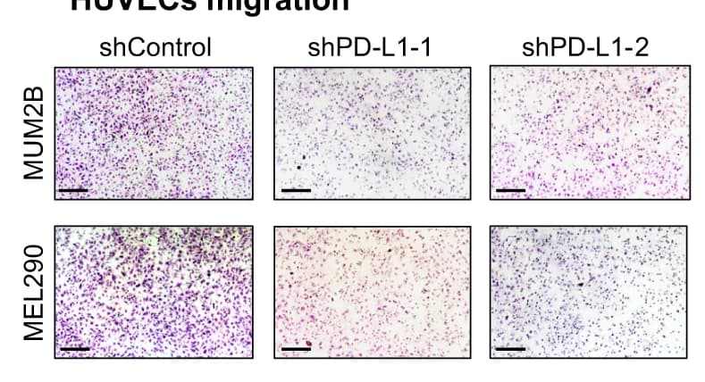 Open access visualization of Microscopy, HUVEC Migration Assay, Conditional Medium, PD-L1 Silenced Cells, Control Cells