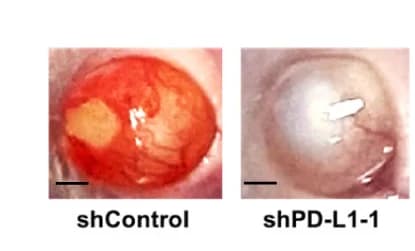 Open access visualization of Photo, Representative Images, UM Orthotopic Xenografts, MUM2B Cells, Control shRNA