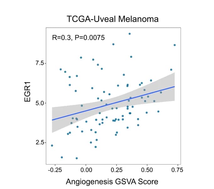 Open access visualization of Scatter Plot, Regression Plot, EGR1, Angiogenesis, GSVA Score