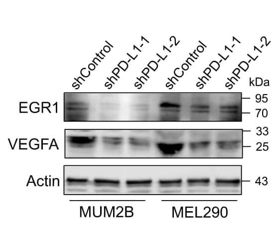 Open access visualization of Gel, Western Blot, EGR1, VEGFA, PD-L1-silenced Cells