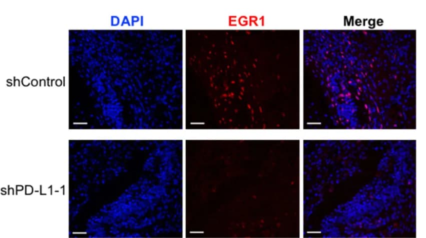 Open access visualization of Microscopy, IF Images, EGR1, UM Orthotopic Xenografts, Immunofluorescence