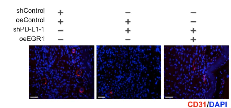 Open access visualization of Microscopy, Table Image, IF Images, CD31, UM Orthotopic Xenografts