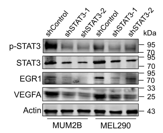 Open access visualization of Gel, Western Blot, p-STAT3, STAT3, EGR1