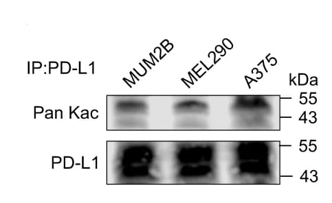 Open access visualization of Gel, Western Blot, PD-L1, Acetylation, MUM2B Cells