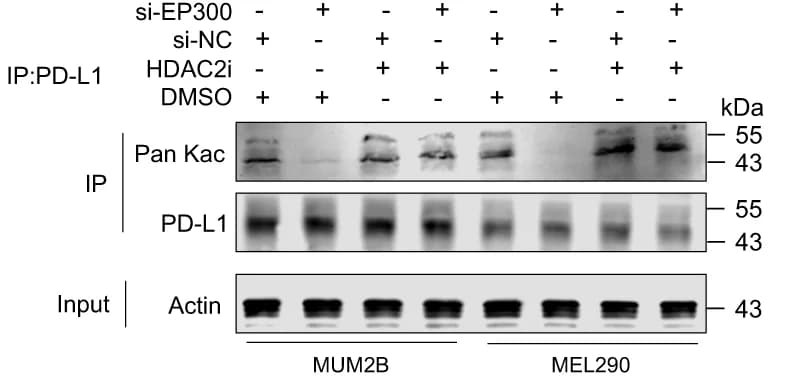 Open access visualization of Gel, Western Blot, PD-L1, Acetylation, MUM2B Cells