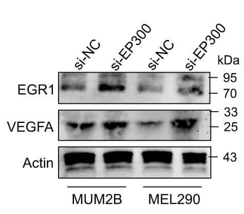 Open access visualization of Gel, Western Blot, EGR1, VEGFA, MUM2B Cells
