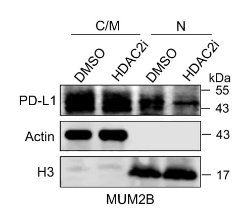 Open access visualization of Gel, Western Blot, PD-L1, Cytoplasmic/Membrane Fraction, Nuclear Fraction