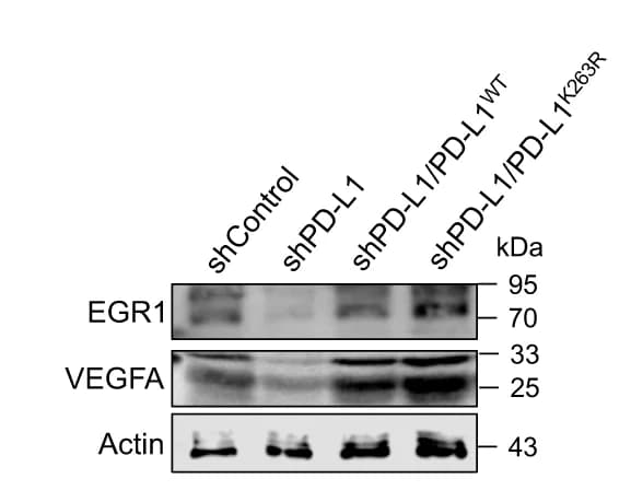 Open access visualization of Gel, Western Blot, EGR1, VEGFA, MUM2B Cells